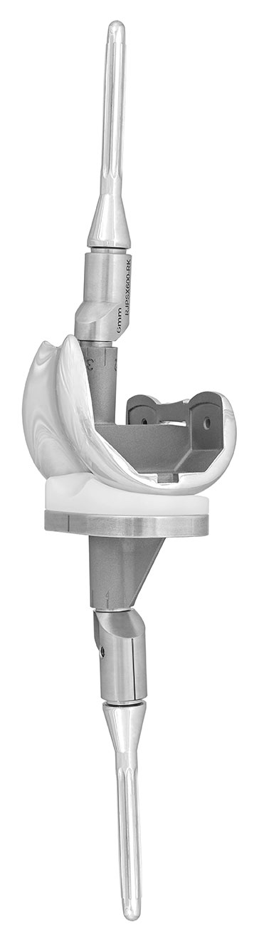 Freedom® PCK Revision Knee